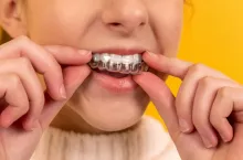 &lt;p&gt;Nakładki na zęby Dr Smile zostały hitem mediów społecznościowych.&lt;/p&gt;